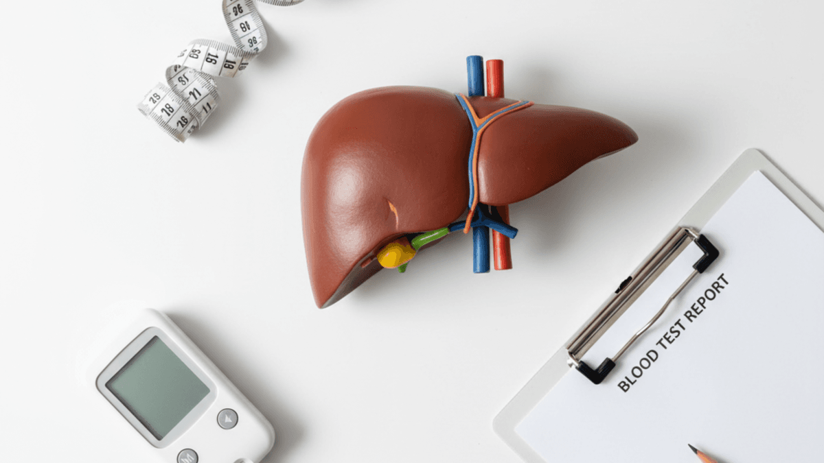 fatty liver treatment without medication illustrated with liver model and metabolic assessment tools