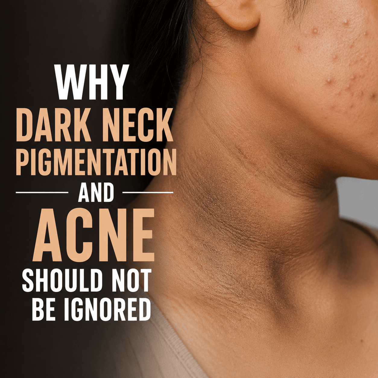 dark neck pigmentation